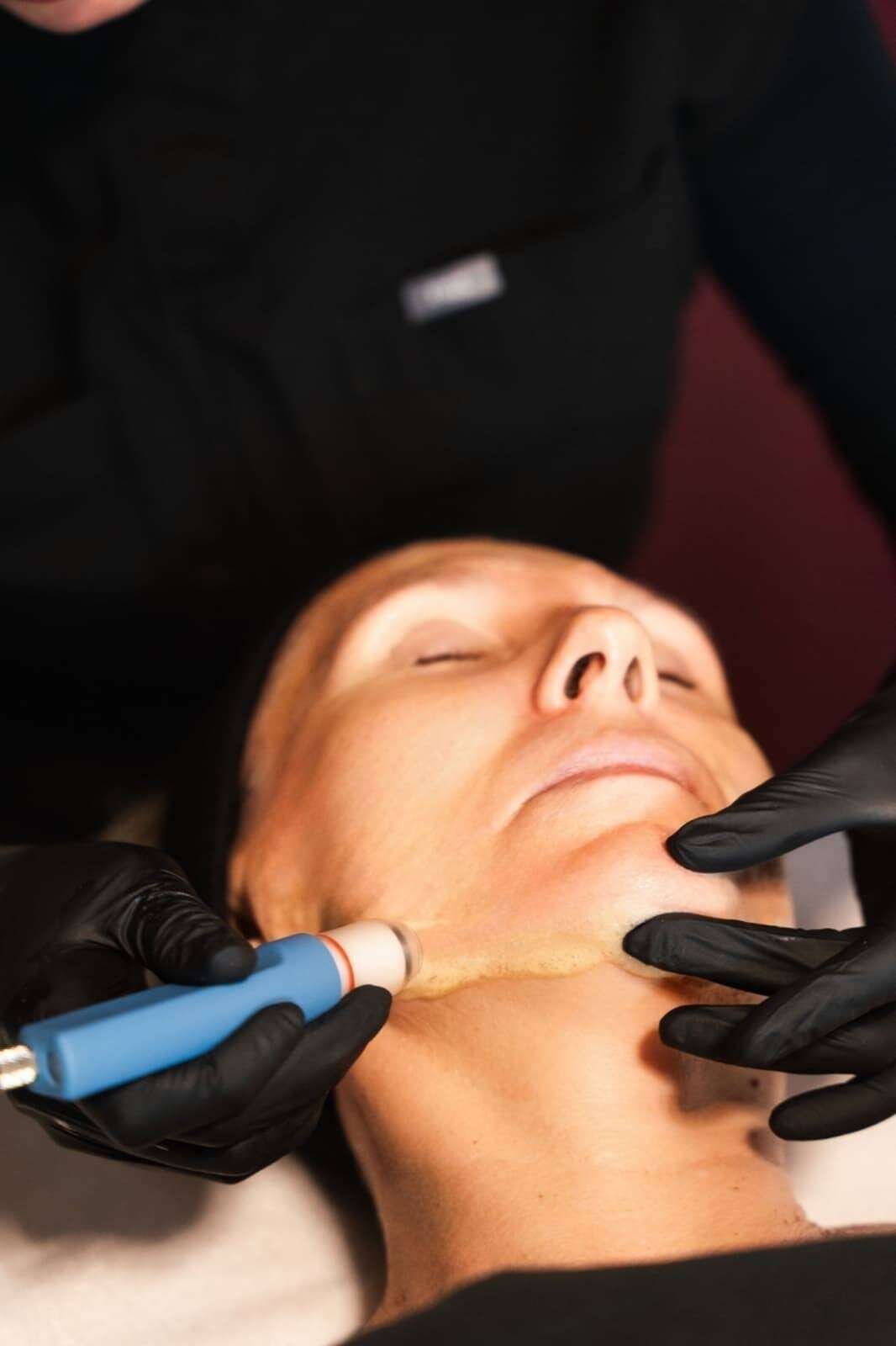 Wet Microdermabration