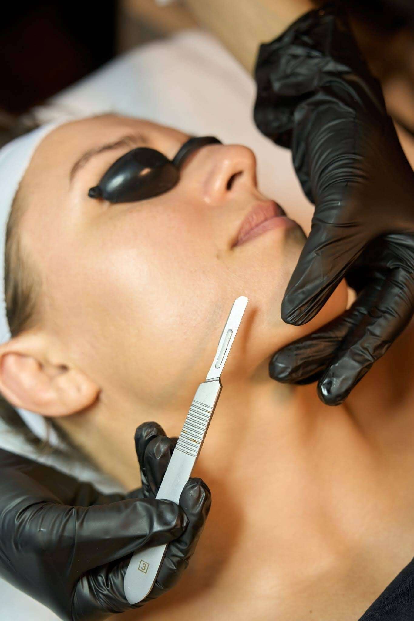 Dermaplaning Facia
